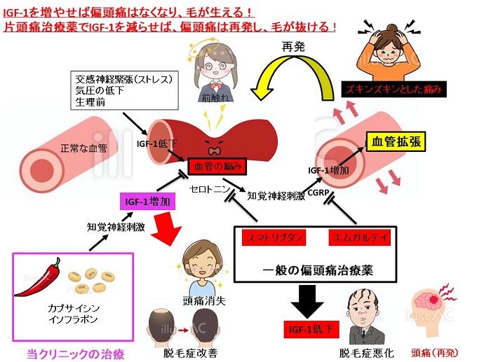 円形脱毛症　病院